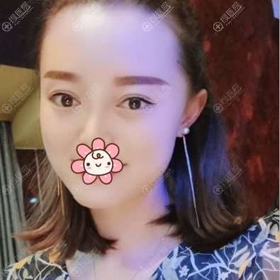 ˫��Ƥ�ָ���μӾۻᱻ��ҿ���
