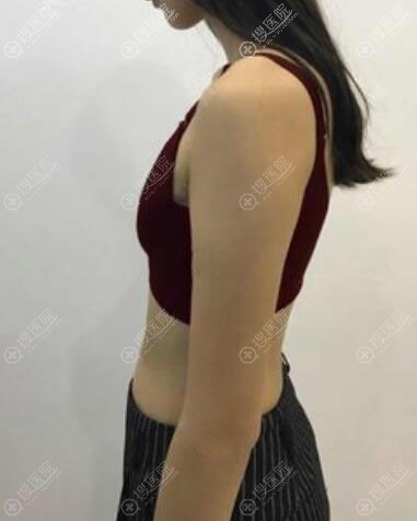 <!--<i data=20240710 data-id=11953></i>-->医疗美容找费博文韬做自体脂肪隆胸案例 <!--<i data=20240710 data-id=11953></i>-->医疗美容找费博文韬做自体脂肪隆胸案例