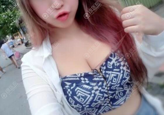 在<!--<i data=20240710 data-id=11953></i>-->医疗美容找费博文韬做自体脂肪隆胸效果怎么样 在<!--<i data=20240710 data-id=11953></i>-->医疗美容找费博文韬做自体脂肪隆胸效果怎么样