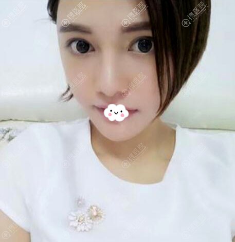 惠州惠阳丽港注射瘦脸除皱效果怎么样 惠州惠阳丽港注射瘦脸除皱效果怎么样