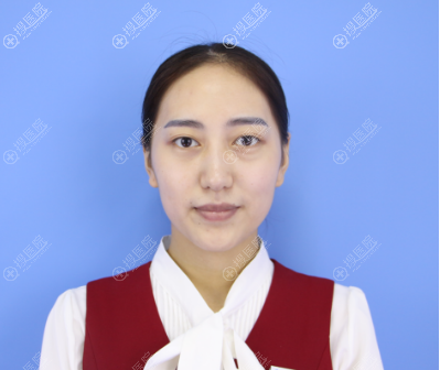 在上海逆时针祛眼袋手术前 在上海逆时针祛眼袋手术前