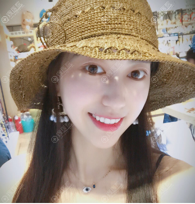 上海逆时针医疗美容祛眼袋真人案例 上海逆时针医疗美容祛眼袋真人案例
