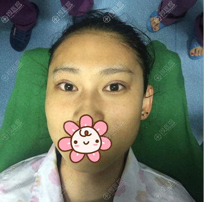 �����ź�������˫��Ƥ���󼴿�
