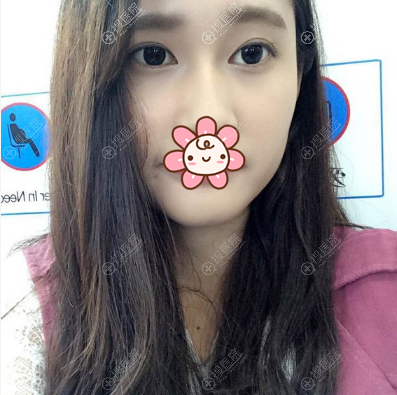 ������˫��Ƥ����2����Ч��