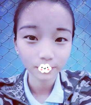 �ɶ�������������˫��Ƥ+���۽����˰���