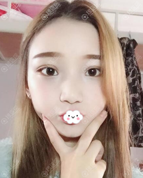 �ɶ���˫��Ƥ�ļҺã��ɶ���������˫��Ƥ����Ч��