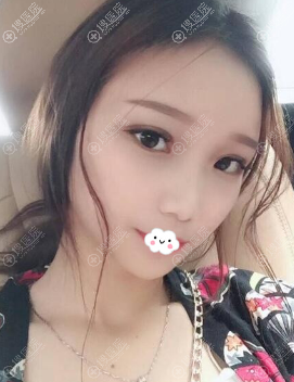 �ɶ���������˫��Ƥ+���۽�����ָ�Ч��