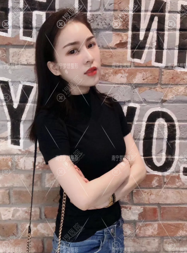 南宁梦想超皮秒祛斑一个月效果图 南宁梦想超皮秒祛斑一个月效果图