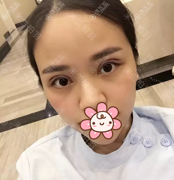 �����������������˫��Ƥ����2��