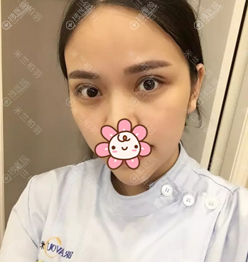 �������������˫��Ƥ��5��ָ�Ч��
