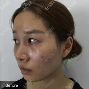 �Դӿ��˸��ݺ�Ͽ��������˫��Ƥ������;������������ۺ���