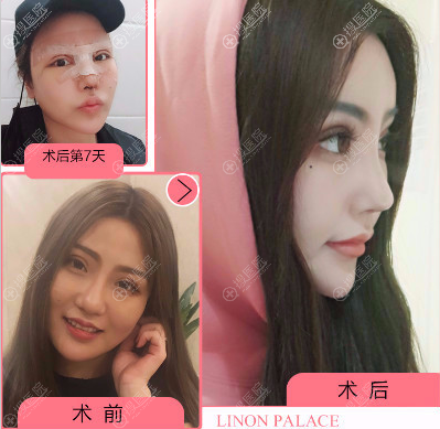 ����������ҽ������˫��Ƥ¡��