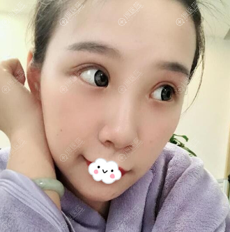 成都铜雀台江涛眼部修复效果怎么样 成都铜雀台江涛眼部修复效果怎么样
