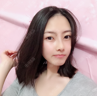 看长沙安吉娜赵福德做鼻子怎么样 看长沙安吉娜赵福德做鼻子怎么样