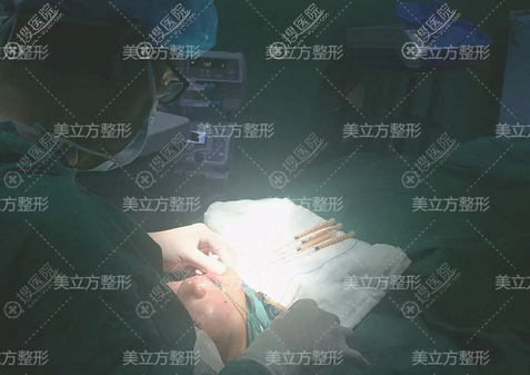 双眼皮脂肪填充手术过程图 双眼皮脂肪填充手术过程图