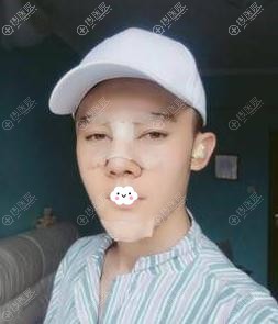 <!--<i data=20240710 data-id=12479></i>-->¡��+����֬�����ͷ+������°�Ч��ͼ