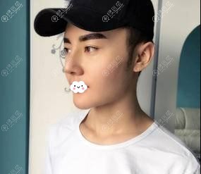 <!--<i data=20240710 data-id=12479></i>-->¡��+����֬������ͷ+���°ͻָ���Ƭ