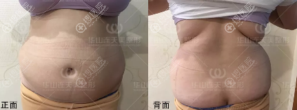 19���Ů�������ں�����������������֬�����A4���ģ�