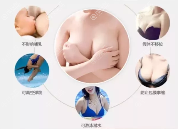 运城丽都内窥镜隆胸的优势有哪些 运城丽都内窥镜隆胸的优势有哪些