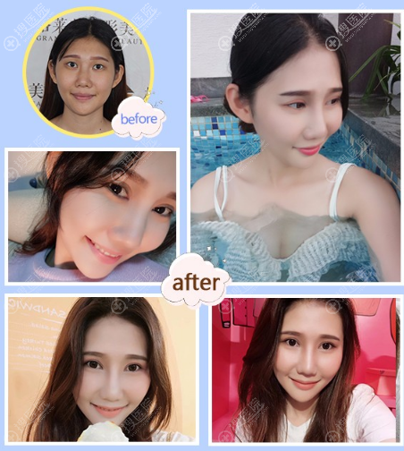 ���ݸ������ӵ³�����˫��Ƥ����