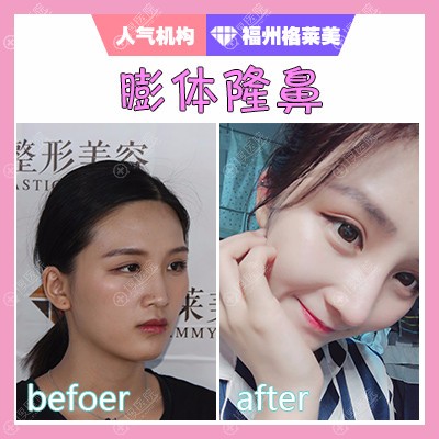���ݸ������ӵ³���������¡�ǰ���