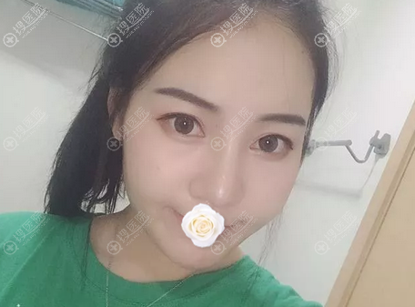 在昆明圣雅隆鼻后的生活照 在昆明圣雅隆鼻后的生活照