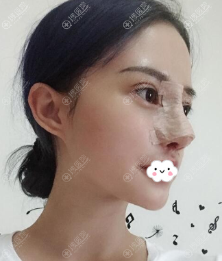 �ɶ������ü�˫��Ƥ+¡�ǰ���Ч��ͼ