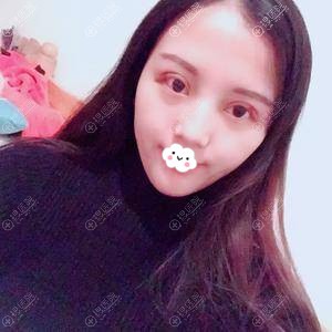 �ɶ���������ʽ˫��Ƥ�����3��Ч��