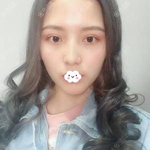 �ɶ��������̺��κ�ʽ˫��Ƥ����Ч��ͼ