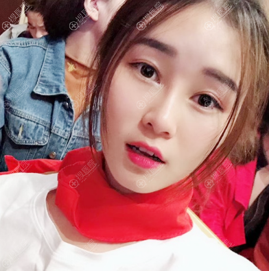 �����������ұ�����˫��Ƥ¡�ǰ���ͼ