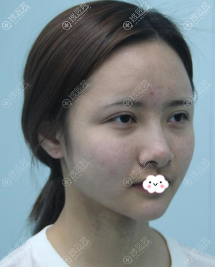 ���������۲��޸���ô�����峤��˫��Ƥʧ���޸���������ָ�ͼ