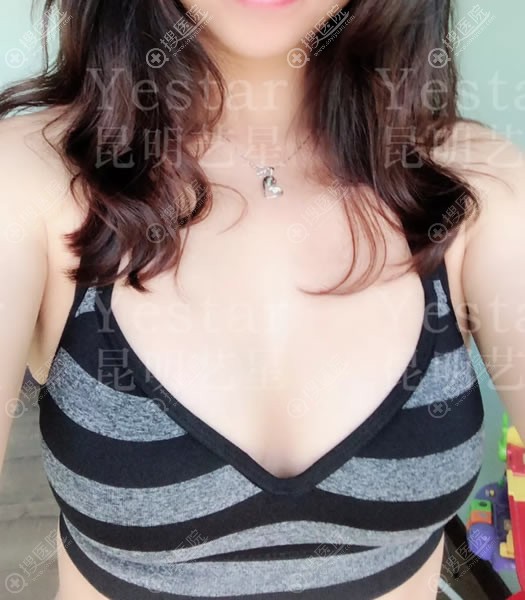 ����������������֬��¡�ذ���2����Ч��