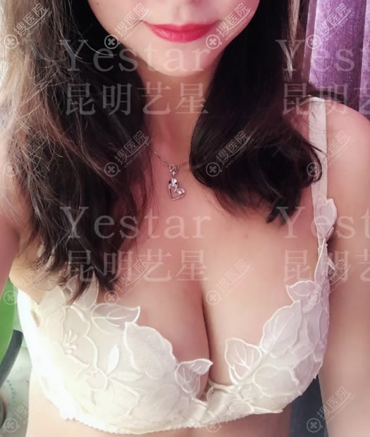 ������������֬��¡��4����Ч��