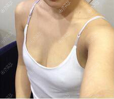 不知贵阳美莱和华美隆胸哪家好?对比后让谢占军做假体隆胸 不知贵阳美莱和华美隆胸哪家好?对比后让谢占军做假体隆胸