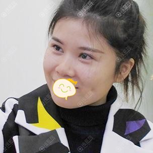 找重庆红颜拜博李星劼做鼻综合,拍照再也不用找角度了