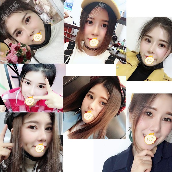 红颜拜博恢复后组合案例图 红颜拜博恢复后组合案例图