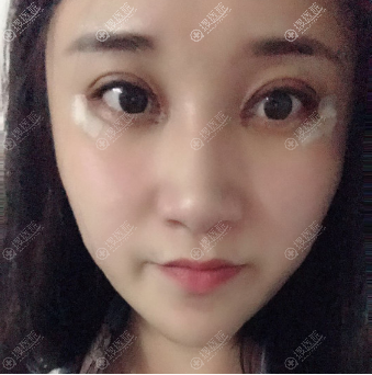 ����Сկ������˫��Ƥ����