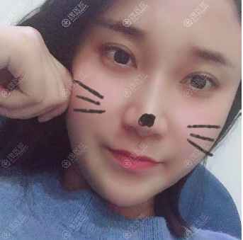 ����Сկ��������˫��Ƥ��ô��