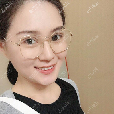 线yestar美杜莎综合美眼术后7天效果 线yestar美杜莎综合美眼术后7天效果