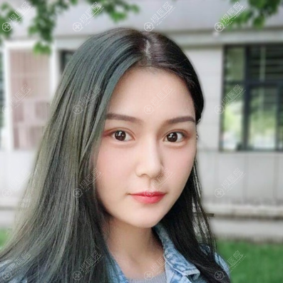 西安yestar宋蔚做双眼皮怎么样 西安yestar宋蔚做双眼皮怎么样