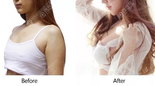 ����¡�غ�̺۶���ָܻ���?�������ټ���������1��̺�Ч��ͼ