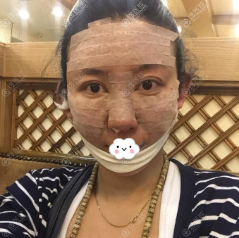 ����Ԫ���¾��۱�����������Ч��