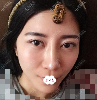 ����Ԫ��Ԫ��̬˫��Ƥ+�����Ǹ���¡�ǰ���Ч��ͼ
