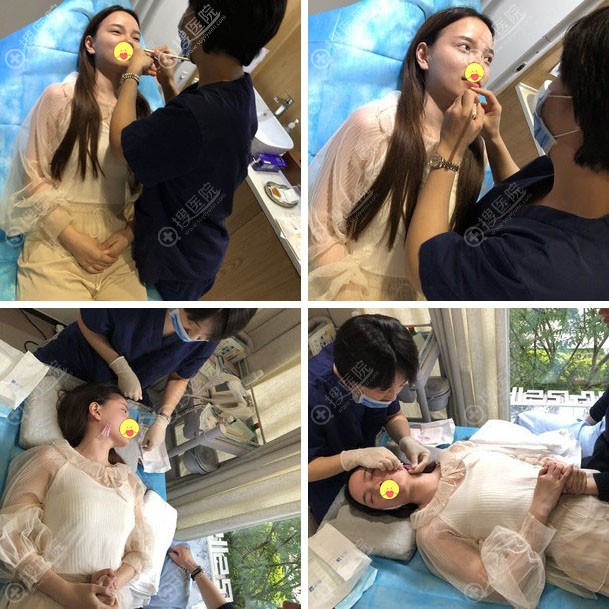 通过面部埋线提升到底能改变多少?看沈阳和颜美帕刘喆院长案例