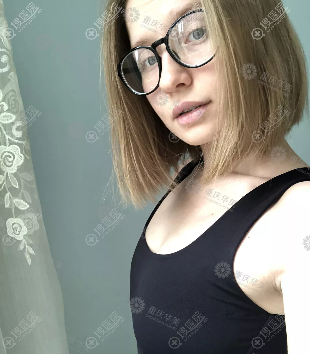 重庆隆胸哪个医生好?重庆华美杨丽萍做假体隆胸8800元附案例