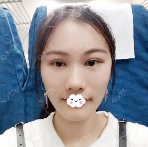 ���������º�����ۺ�+�沿��䰸���ָ�ͼ