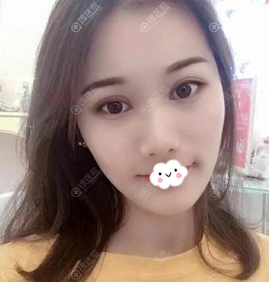 ���������º��˫��Ƥ+���۽����˰����ָ�ͼ