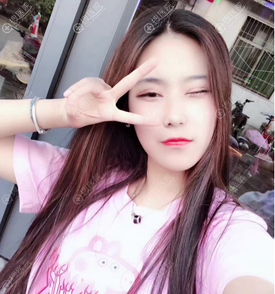 ˫��Ƥ���۽�����2����Ƭ