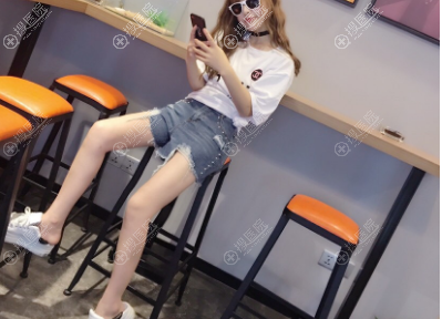 无锡<!--<i data=20240710 data-id=672></i>-->彭建院长吸脂案例 无锡<!--<i data=20240710 data-id=672></i>-->彭建院长吸脂案例