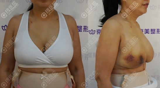 �˽����������ȡ������֢֮��,�ñ�������ʤ���ز���º�¡��